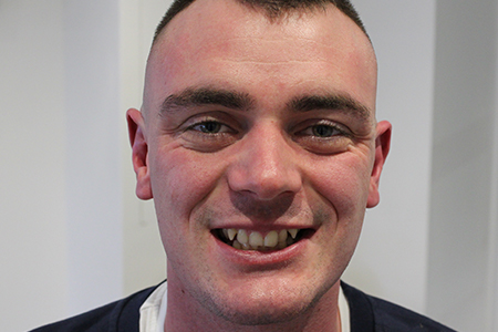 Before and After Invisalign Treatment Milton Keynes Before and After Invisalign Treatment Milton Keynes