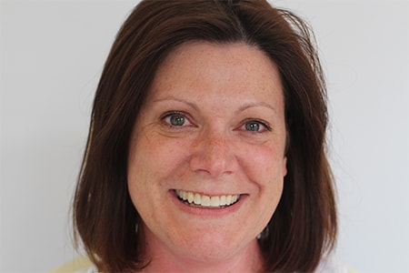 Before and After Invisalign Treatment Milton Keynes Before and After Invisalign Treatment Milton Keynes