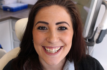 Before Invisalign Treatment Reading Smiles