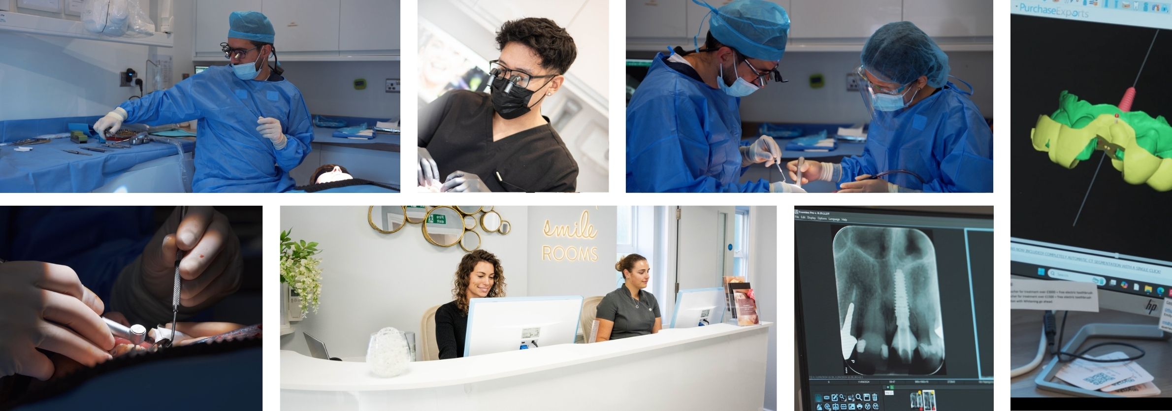 Dental Implants
