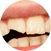 Damaged tooth
